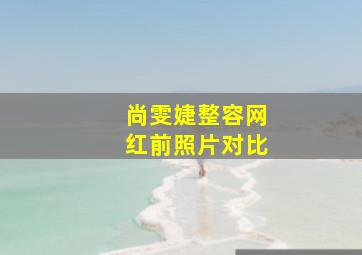 尚雯婕整容网红前照片对比