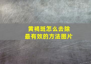 黄褐斑怎么去除最有效的方法图片