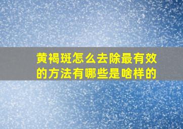 黄褐斑怎么去除最有效的方法有哪些是啥样的